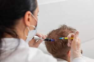 Exosomes הזרקת אקסוזומים